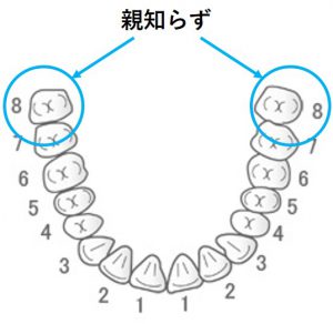 親知らずの場所