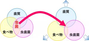 虫歯ができるリスクを減らすには