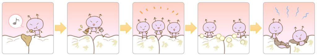 虫歯のでき方