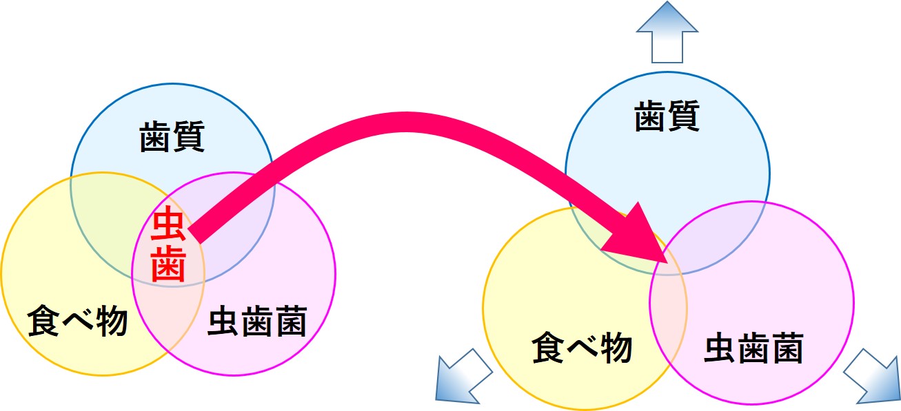 虫歯ができるリスクを減らすには